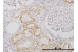 Image no. 2 for anti-Peptidase Inhibitor 15 (PI15) (AA 18-118) antibody (ABIN599240) (PI15 抗体  (AA 18-118))