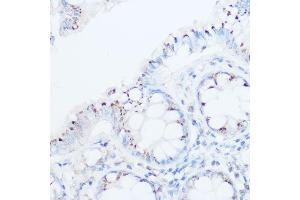 Immunohistochemistry of paraffin-embedded human colon using UBI Rabbit pAb (ABIN6134945, ABIN6149844, ABIN6149847 and ABIN6218504) at dilution of 1:500 (40x lens). (UBIAD1 抗体  (AA 1-100))
