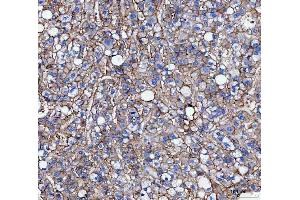 IHC analysis of CD166/ALCAM using anti-CD166/ALCAM antibody (ABIN5518801).