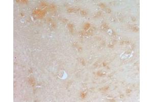 Rat brain tissue was stained by anti-AdipoR2 (374-386) (Human) Antiserum (Adiponectin Receptor 2 抗体  (AA 374-386))