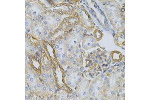Immunohistochemistry (Paraffin-embedded Sections) (IHC (p)) image for anti-Heat Shock Protein 90kDa alpha (Cytosolic), Class B Member 1 (HSP90AB1) (AA 1-300) antibody (ABIN3021406)