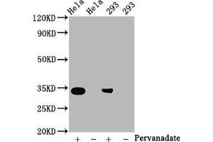 Western Blot Positive WB detected in:Hela whole cell lysate, 293 whole cell lysate(treated with Pervanadate or not) All lanes:Phospho-CDK2 antibody at 0. (Recombinant CDK2 抗体  (pTyr15))