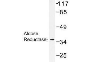 Image no. 1 for anti-Aldo-Keto Reductase Family 1, Member B1 (Aldose Reductase) (AKR1B1) antibody (ABIN317815) (AKR1B1 抗体)