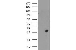 Western Blotting (WB) image for anti-Cyclin-Dependent Kinase Inhibitor 3 (CDKN3) antibody (ABIN1497459) (CDKN3 抗体)