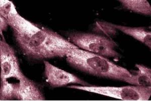 Immunoflouresence staining of human fibroblasts. (DAP Kinase 1 抗体  (AA 694-947))