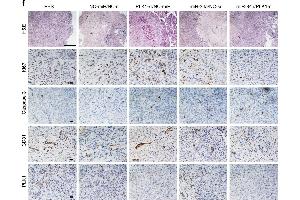 In vivo antitumor effect of miRNA-siRNA combination. (PLK1 抗体  (AA 201-300))