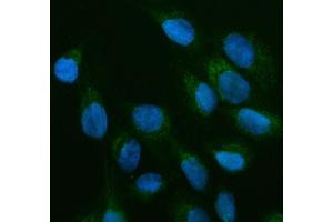 IF analysis of OFD1 using anti-OFD1 antibody (ABIN7602739).