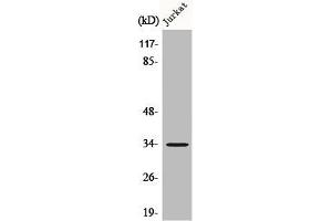 Western Blot analysis of Jurkat cells using C/EBP ε Polyclonal Antibody (CEBPE 抗体)