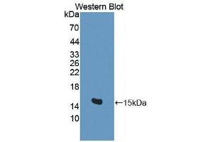 Western blot analysis of the recombinant protein. (BAMBI 抗体  (AA 29-130))