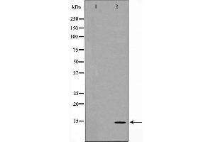 Western blot analysis of Hela cell lysate, using MYL9 Antibody. (MYL9 抗体  (N-Term))