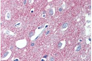 Brain, cortex, Human: Formalin-Fixed, Paraffin-Embedded (FFPE)