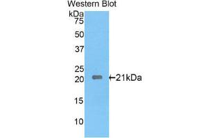 Western Blotting (WB) image for anti-Interleukin 17 Receptor E (IL17RE) (AA 457-626) antibody (ABIN1859366) (IL17RE 抗体  (AA 457-626))