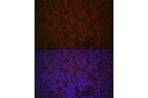 Immunofluorescence analysis of human spleen using SHIP11 Rabbit mAb (ABIN7267882) at dilution of 1:100 (40x lens). (INPP5D 抗体)