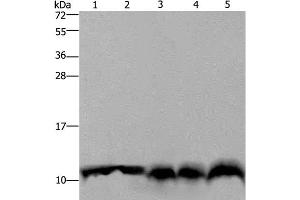 Western Blot analysis of Mouse pancreas tissue, Hela cell and Mouse liver tissue, A549 and 293T cell using UBB Polyclonal Antibody at dilution of 1:500 (Ubiquitin B 抗体)