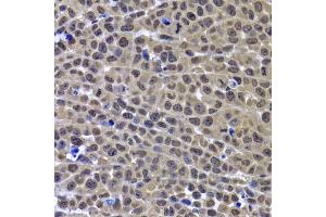 Immunohistochemistry of paraffin-embedded mouse cancer using GPS1 antibody. (GPS1 抗体)