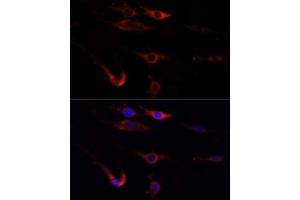 Immunofluorescence analysis of PC12 cells using MTOR antibody.