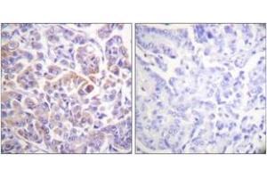 Immunohistochemistry (IHC) image for anti-V-Raf-1 Murine Leukemia Viral Oncogene Homolog 1 (RAF1) (AA 271-320) antibody (ABIN2888728) (RAF1 抗体  (AA 271-320))