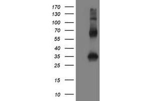 Image no. 2 for anti-Snail Family Zinc Finger 2 (SNAI2) antibody (ABIN1500979) (SLUG 抗体)