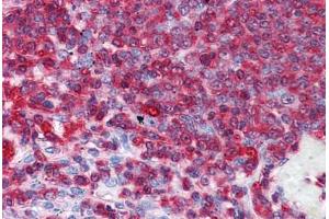 Human Spleen: Formalin-Fixed, Paraffin-Embedded (FFPE) (GDI2 抗体  (AA 1-197))