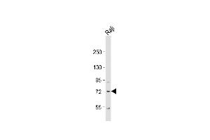 Anti-KLHL6 Antibody (C-term) at 1:1000 dilution + Raji whole cell lysate Lysates/proteins at 20 μg per lane. (KLHL6 抗体  (C-Term))