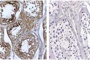 Immunohistochemistry Rabbit Anti-Human DNMT3L Antibody 1:500 (DNMT3L 抗体  (AA 150-175))