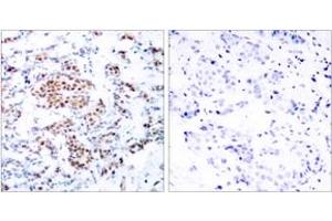 Immunohistochemistry (IHC) image for anti-Signal Transducer and Activator of Transcription 5A (STAT5A) (AA 666-715) antibody (ABIN2889069) (STAT5A 抗体  (AA 666-715))