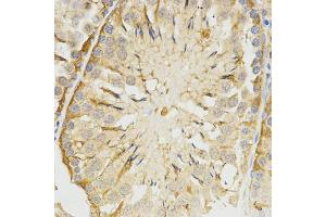 Immunohistochemistry of paraffin-embedded rat testis using TPM2 antibody (ABIN5971583) at dilution of 1/200 (40x lens). (TPM2 抗体)