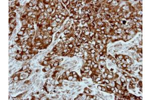 IHC-P Image Immunohistochemical analysis of paraffin-embedded H661 xenograft, using PPP3CB, antibody at 1:500 dilution. (PPP3CB 抗体  (Center))