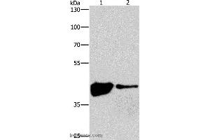 Western blot analysis of 293T and human fetal brain tissue, using MAPK11  Polyclonal Antibody at dilution of 1:200 (MAPK11 抗体)
