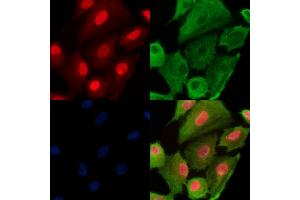 Phospho-RAD18 (Ser99) Antibody staining A549 cells(H2O2 treatment) by IF/ICC. (RAD18 抗体  (pSer99))