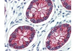 Human Colon (formalin-fixed, paraffin-embedded) stained with CLDN1at 10 µg/ml followed by biotinylated goat anti-rabbit IgG secondary antibody, alkaline phosphatase-streptavidin and chromogen. (Claudin 1 抗体  (C-Term))