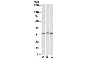 Western blot testing of Daudi (A), Jurkat (B) and K562 (C) lysates with LIVIN antibody at 0. (BIRC7 抗体)