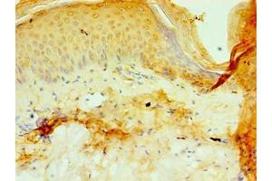 Immunohistochemistry of paraffin-embedded human skin tissue using ABIN7164787 at dilution of 1:100