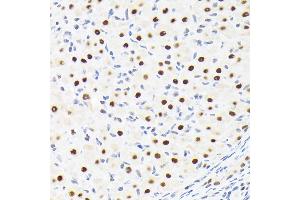 Immunohistochemistry of paraffin-embedded rat ovary using SUPT5H/SPT5 Rabbit mAb (ABIN7270878) at dilution of 1:100 (40x lens). (SUPT5H 抗体)
