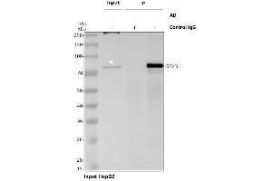 Immunoprecipitating (IP) HRD1/SYVN1 in HepG2 whole cell lysate.