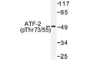 Image no. 1 for anti-Activating Transcription Factor 2 (ATF2) (pThr55), (pThr73) antibody (ABIN317967) (ATF2 抗体  (pThr55, pThr73))