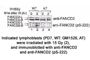 Image no. 1 for anti-Fanconi Anemia, Complementation Group D2 (FANCD2) (AA 217-226), (pSer222) antibody (ABIN363448) (FANCD2 抗体  (pSer222))