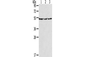 Gel: 8 % SDS-PAGE, Lysate: 40 μg, Lane 1-3: PC3 cells, hela cells, A549 cells, Primary antibody: ABIN7191485(MMP23B Antibody) at dilution 1/200, Secondary antibody: Goat anti rabbit IgG at 1/8000 dilution, Exposure time: 10 seconds (MMP23A 抗体)