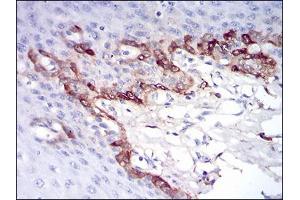 Immunohistochemical analysis of paraffin-embedded esophageal tissues using FTL mouse mAb with DAB staining. (FTL 抗体  (AA 1-157))