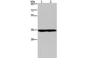 Western Blot analysis of Mouse heart and kidney tissue using NDUFA9 Polyclonal Antibody at dilution of 1:400 (NDUFA9 抗体)