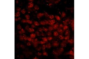 anti-Wilms Tumor 1 Associated Protein (WTAP) (AA 346-396) antibody