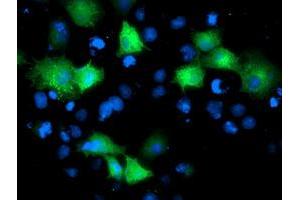 Anti-ARFGAP1 mouse monoclonal antibody (ABIN2454386) immunofluorescent staining of COS7 cells transiently transfected by pCMV6-ENTRY ARFGAP1 (RC206987). (ARFGAP1 抗体)