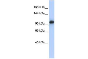 WB Suggested Anti-VPS54 Antibody Titration: 0. (VPS54 抗体  (N-Term))