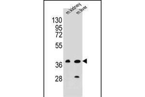 BRUNOL6 Antibody (N-term) (ABIN655660 and ABIN2845132) western blot analysis in mouse kidney,liver tissue lysates (35 μg/lane). (CELF6 抗体  (N-Term))