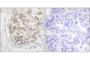 Immunohistochemistry (IHC) image for anti-Protein Kinase, DNA-Activated, Catalytic Polypeptide (PRKDC) (AA 2022-2071), (pSer2056) antibody (ABIN1531584)