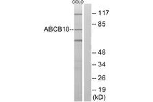 Western blot analysis of extracts from COLO cells, using ABCB10 Antibody. (ABCB10 抗体  (AA 441-490))