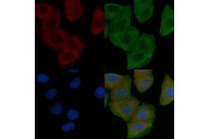 ABIN6259263 and ABIN6274611 staining Hela cells by IF/ICC. (TMEM30B 抗体  (Internal Region))