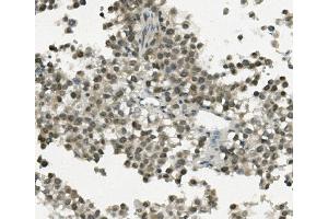 IHC analysis of REC8 using anti-REC8 antibody (ABIN7599473).