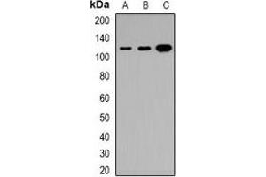 Western blot analysis of Tensin 3 expression in HeLa (A), DLD (B), H9C2 (C) whole cell lysates. (TNS3 抗体)