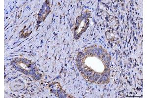 IHC analysis of CYB5B using anti-CYB5B antibody (ABIN7600312).